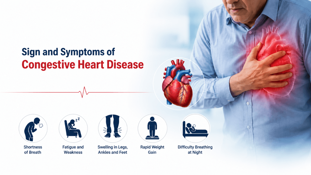 Sign and Symptoms of Congestive Heart Disease