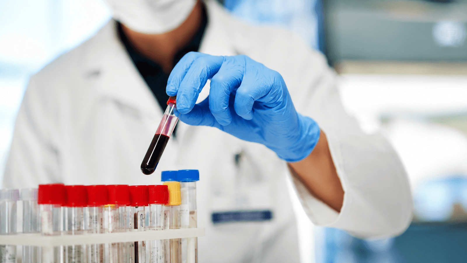 Best haematologist in India — verified blood specialist profiles