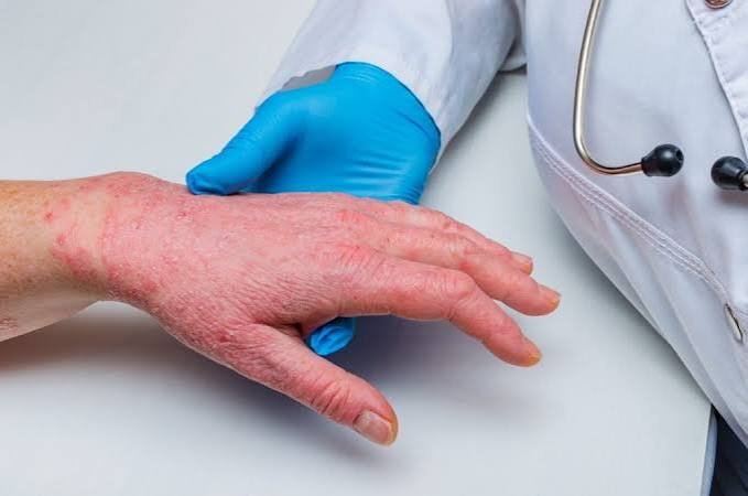 Dermatology