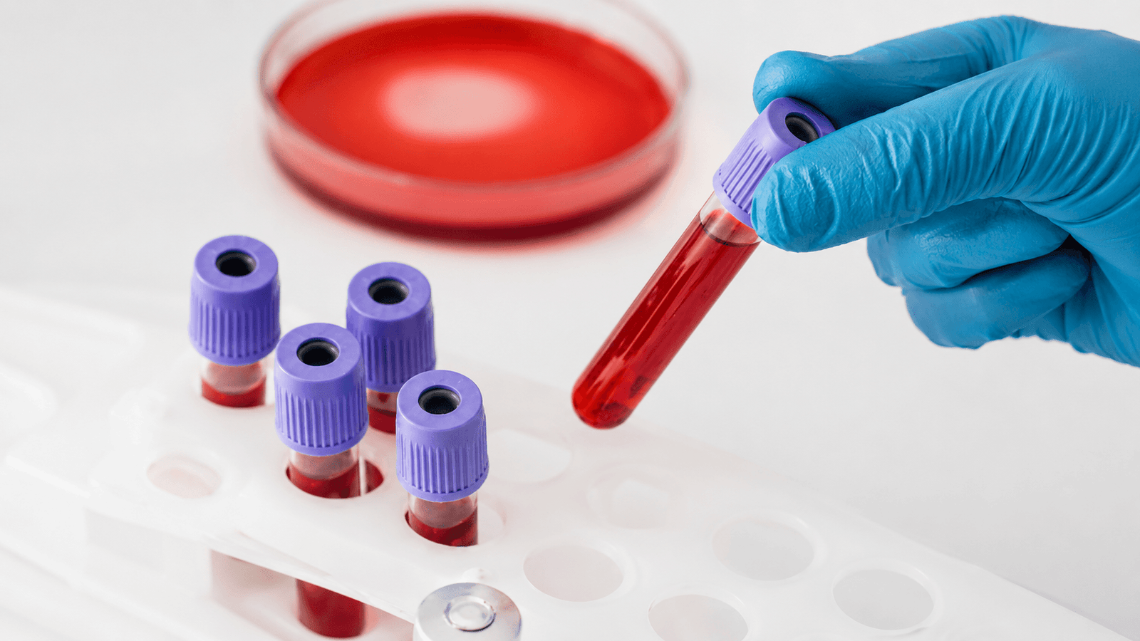 Best haematologist in India examining a patient