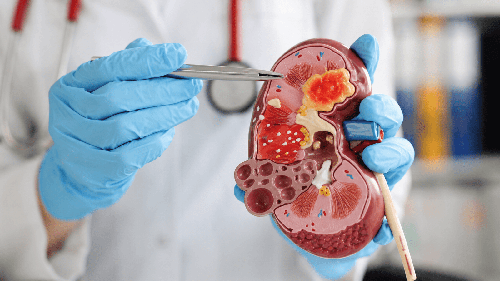 Best nephrologist in India examining a patient