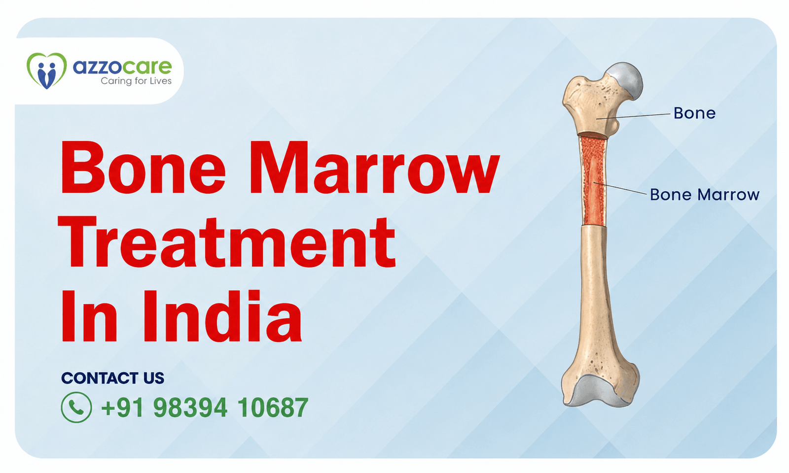 Hematology specialist reviewing bone marrow transplant treatment plan with patient in India