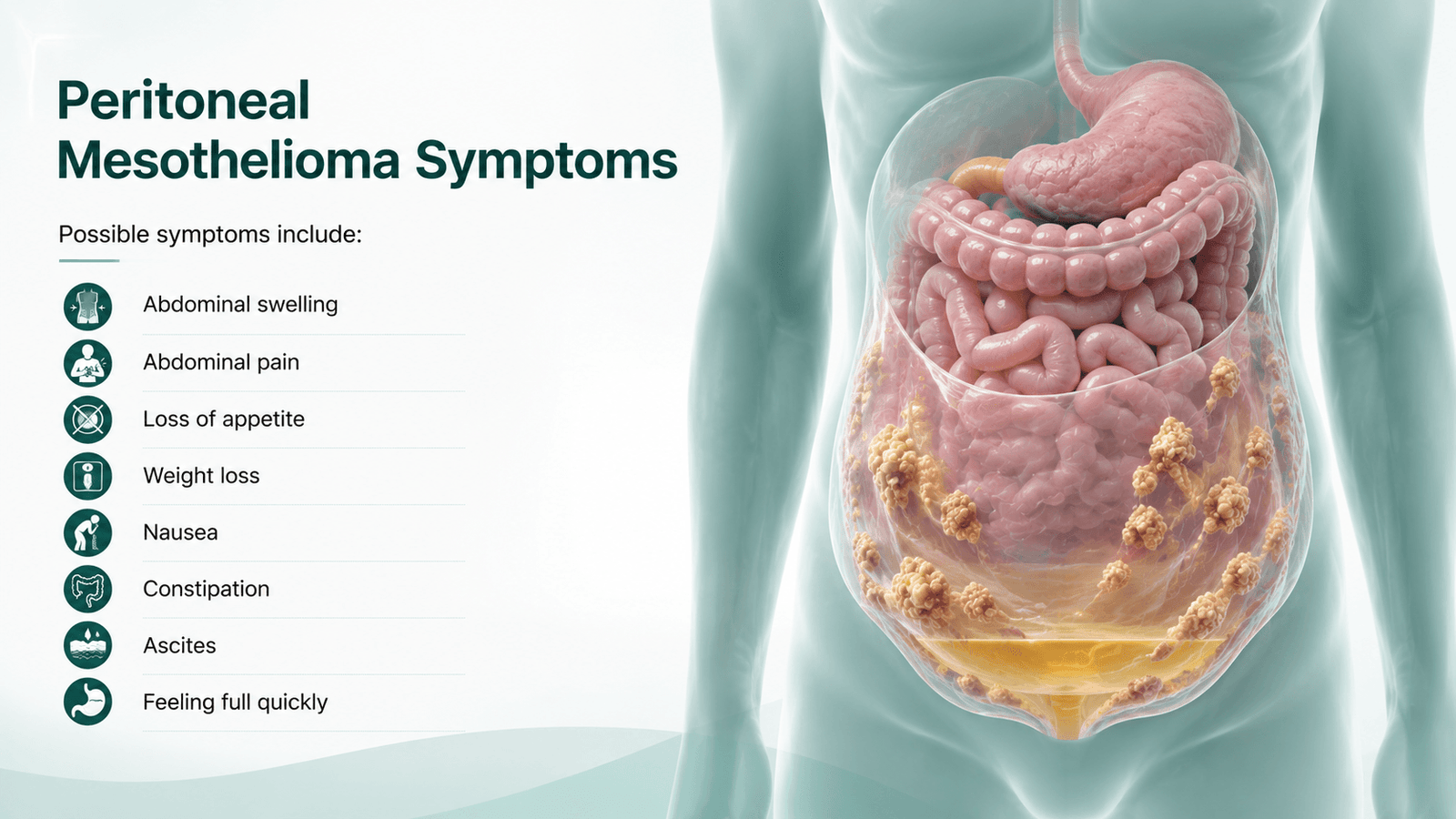 Peritoneal Mesothelioma Symptoms