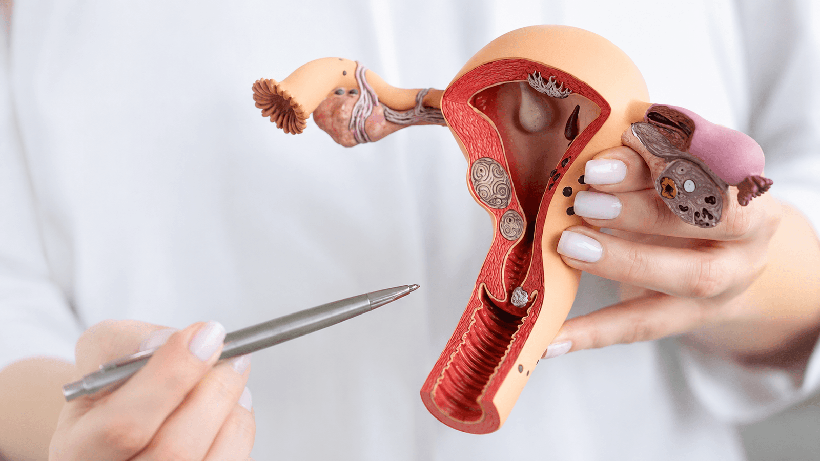 Vaginal cancer treatment cost in India