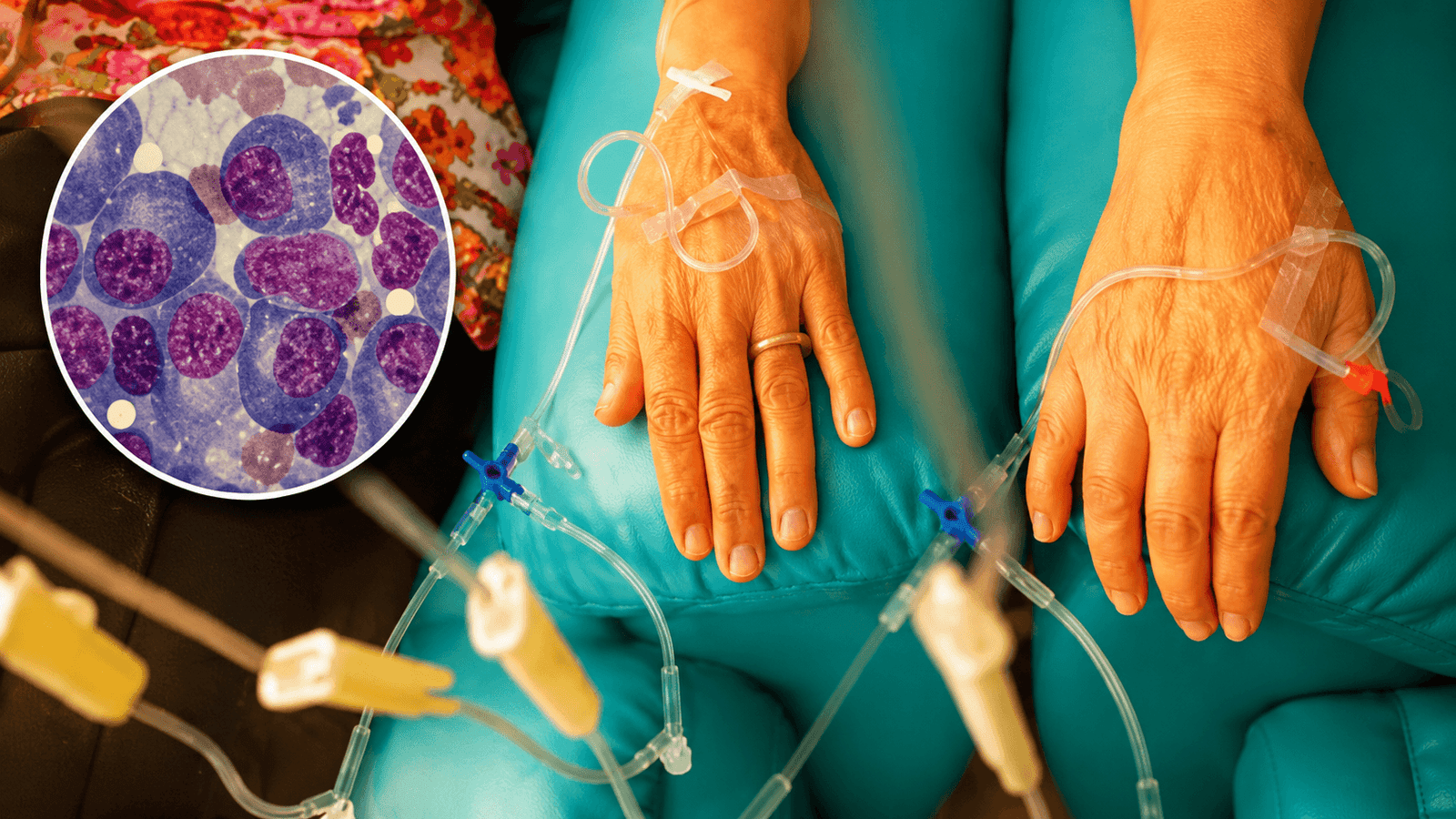 Hematologist reviewing multiple myeloma treatment plan with patient in India