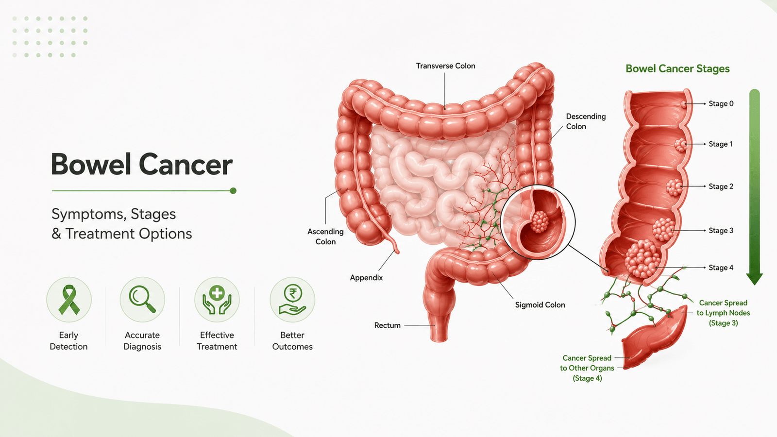 Bowel cancer treatment in India