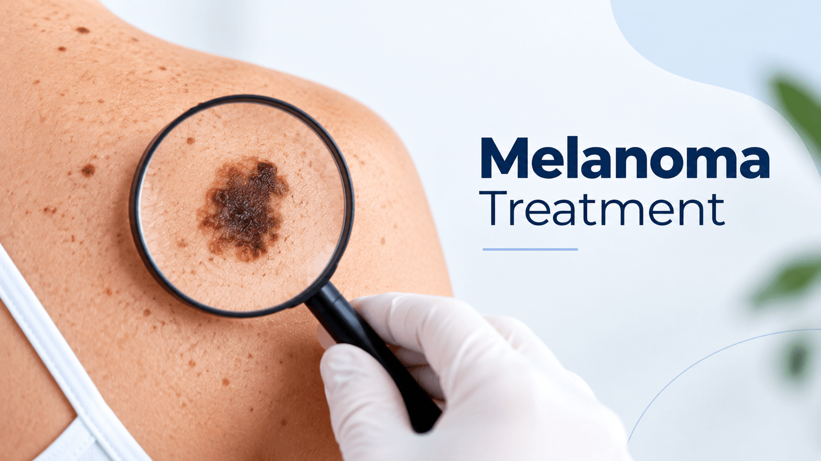 Melanoma Treatment Cost in India