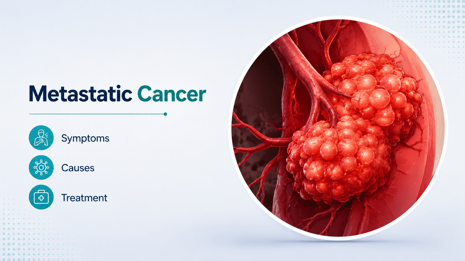 Metastatic cancer treatment in India