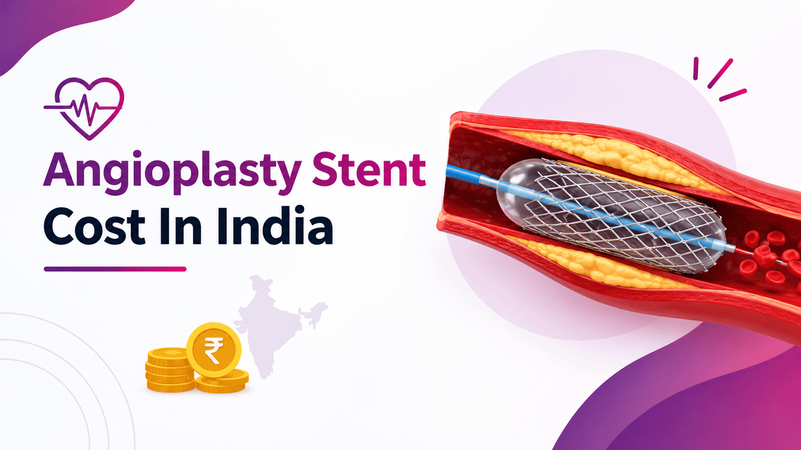 Heart stent cost in India